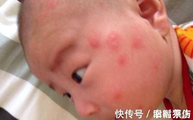 乳酸|被蚊子“选中”的宝宝,是因为甜度高吗?蚊子的口味其实是这样的