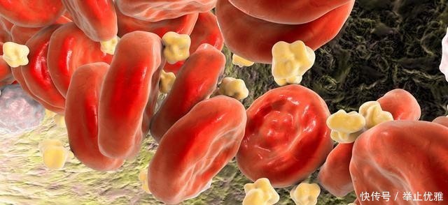 a679|血脂升高后,多吃这4种食物,也许血管胆固醇越来越少