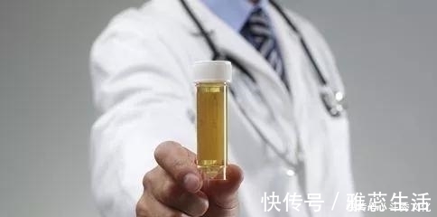 糖尿病人|糖尿病人尿中有泡沫,两个+专家谈治疗方案