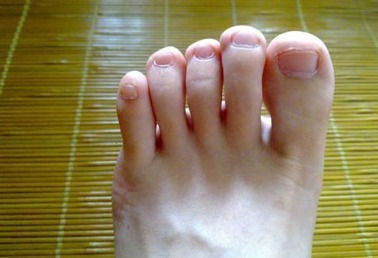 高跟鞋|脚上若没有3个“标记”的人,说明你没被“癌细胞”盯上,恭喜你