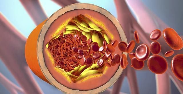 血脂块|110岁长寿老人,血管仅60岁且不堵,秘诀不是少吃肉,而是这3件事