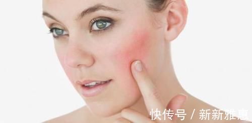 角质层|不会吧不会吧,好多人还不知道自己是敏感肌?怪不得皮肤越来越糟