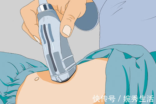 探头|阴式B超和腹式B超,哪个结果更准确?女性该选哪个?医生告诉你