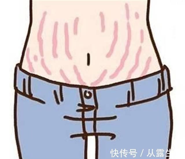 腹部|妊娠纹是怎么产生的?网友用塑料袋像大家展示,简直不要太形象