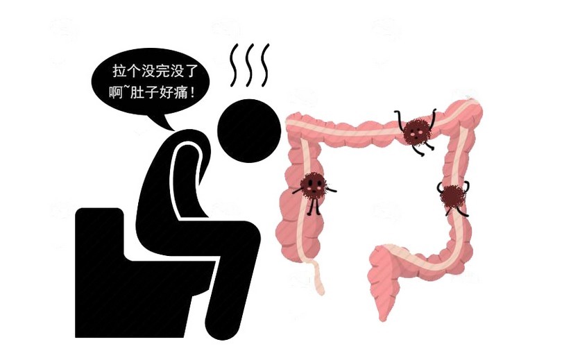 直肠癌|排便后不妨看看,出现便血,这样分析是痔疮还是直肠癌信号!