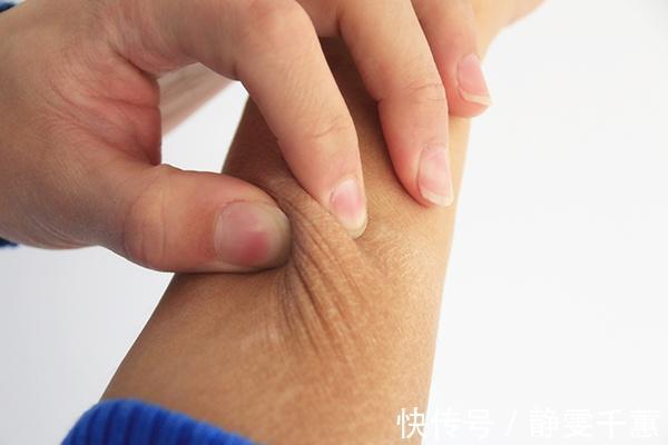 茯苓|气血不足的人，身体多有五种表现，推荐两款食物，帮你补足气血