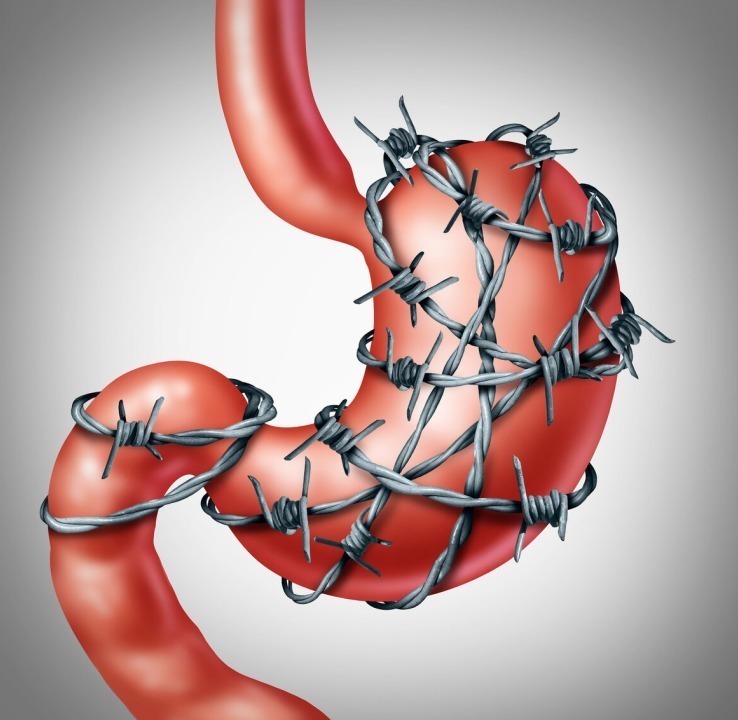 肠胃|研究胃病40年院士养胃其实并不难,日常吃1“零食”,胃会更好