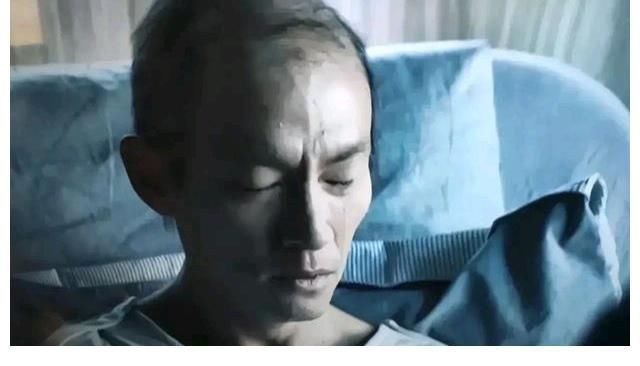 黄磊演的肾癌、看得观众得了尬癌,张震这样一看就知道他做了化疗