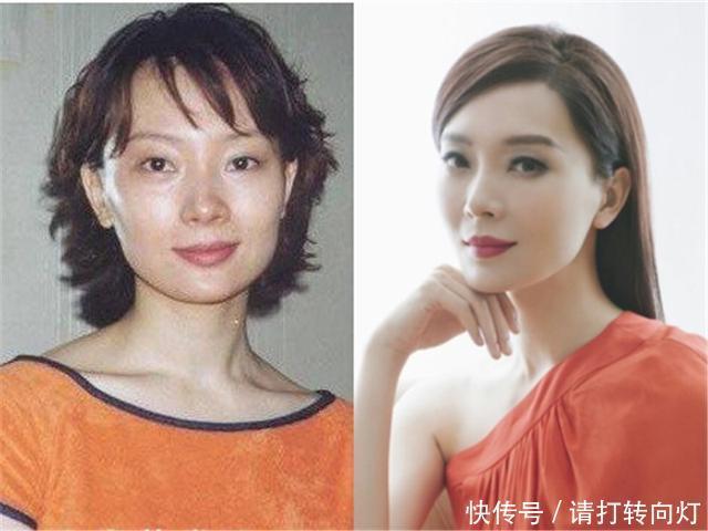 美白|颜值提升|为什么皮肤变白了会更好看有效美白的成分是哪些