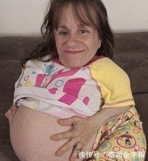 袖珍妈妈|美国身高70厘米的袖珍妈妈,身体肿如气球,如今俩孩子
