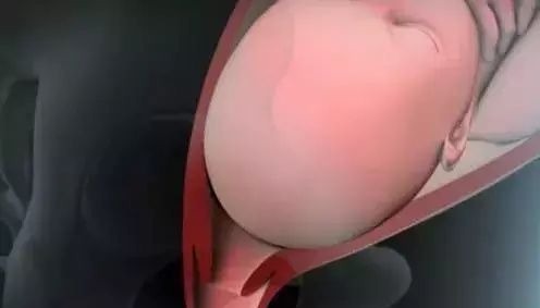 小宝宝|分娩痛得死去活来时宝宝在干嘛?暖哭!你真的不是一个人在战斗!