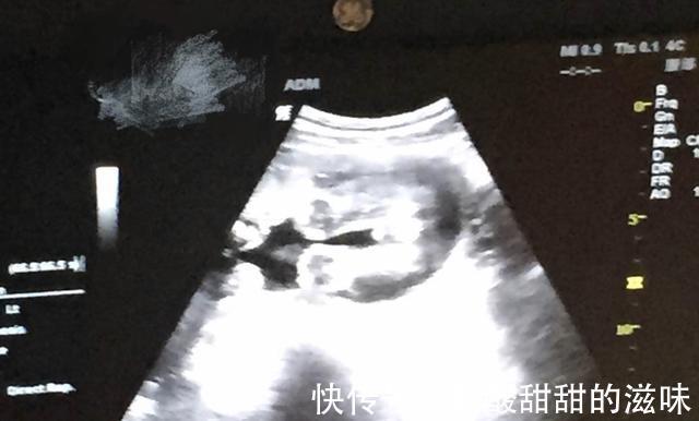 怀孕|产检时,这3句话最好憋住别说,别让自己难堪,你有说过吗