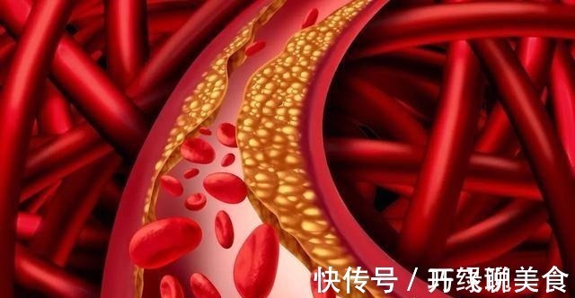 花生|生花生和熟花生,哪个更营养提醒5类人最好少碰,别不当回事