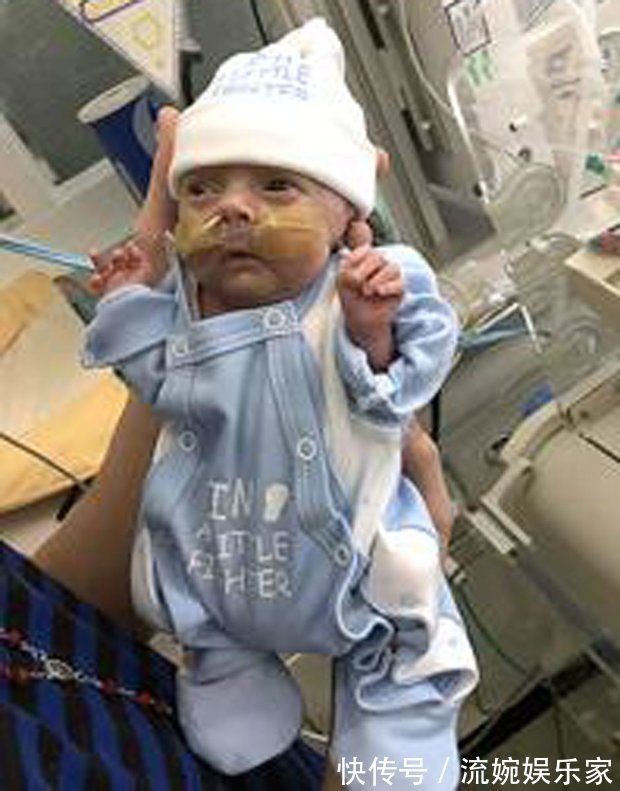 防腐剂|19岁女孩早产生下宝宝,宝宝全身没皮肤,护士都不敢抱