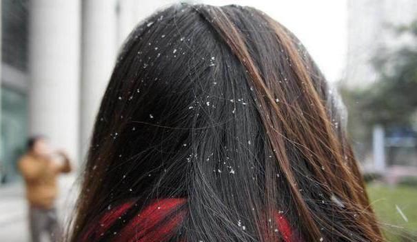 头上有螨虫的人，平时可能会露出4种表现，不要再忽略了