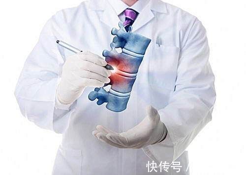 脊髓型頸椎病|脖子一轉就咔咔響！是頸椎病加重，還是脖子要“斷了”？