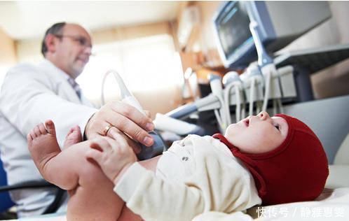 胎记|胎记代表上辈子去世的方式网友大开脑洞那这个死法还真特别