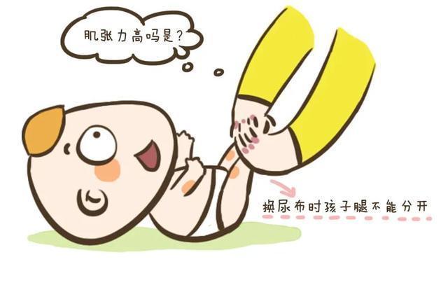 鲍教授|家长咨询:宝宝两个月,医生说腿部肌张力高,对宝宝影响大吗?