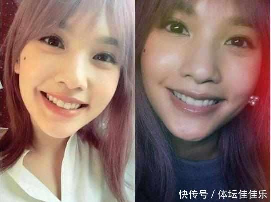 地方|这3个地方有“痣”,是“美人脸”的标志,千万别点掉了