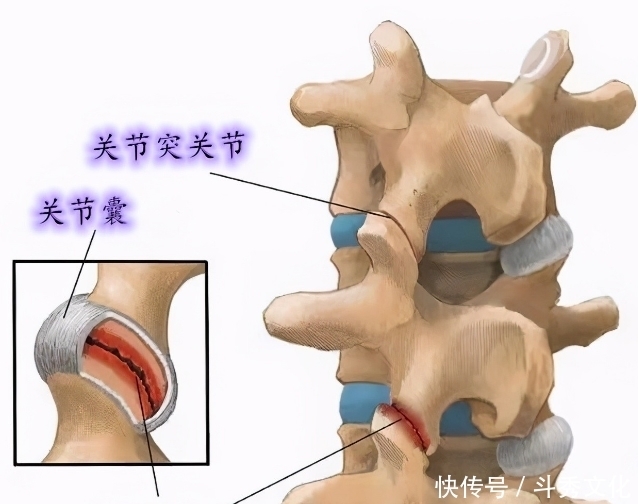 肩膀疼痛,并非肩周炎,问题在哪?您找对没?此文给您全新的认识