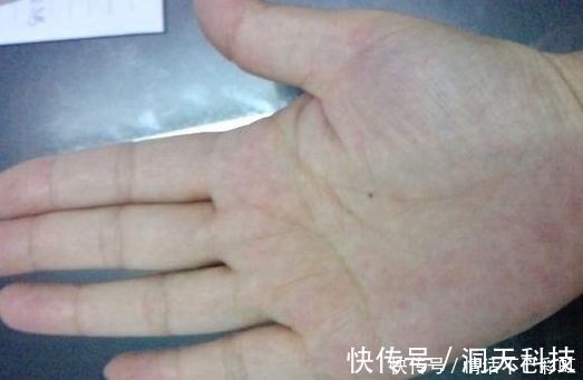 福禄|女人的富贵痣，就是天生的富贵命，一生福禄双全富贵无比锦衣玉食