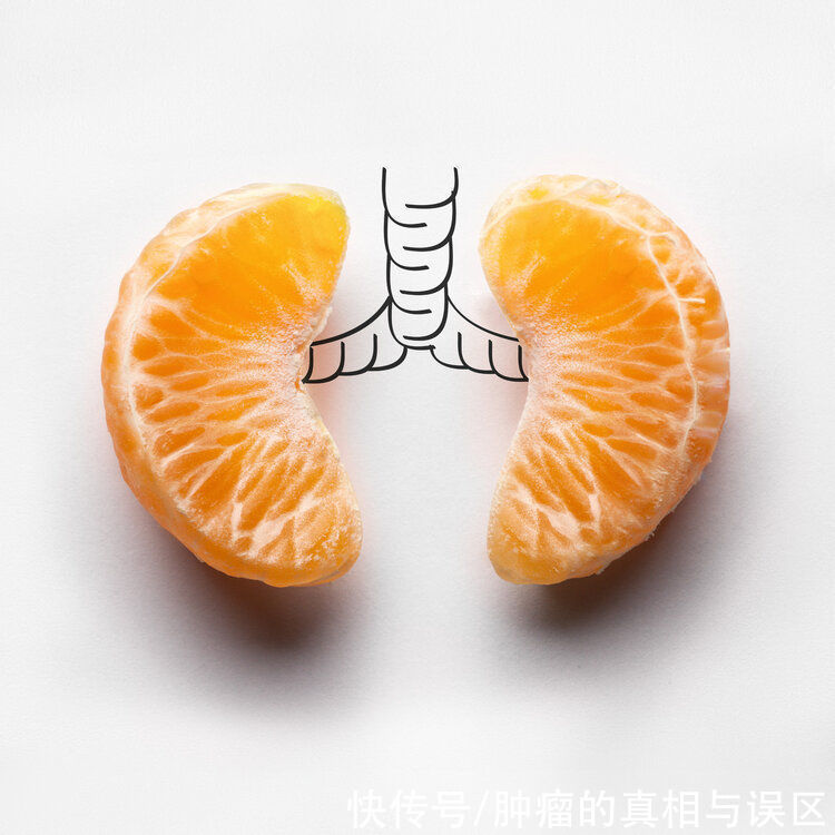 复发|癌症多久不复发才算治愈?4个检查全正常,恭喜你离治愈不远了