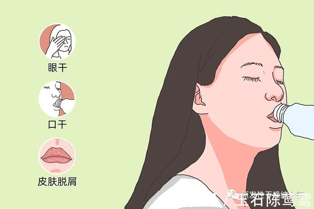 患病率|干燥综合征的鉴别诊断