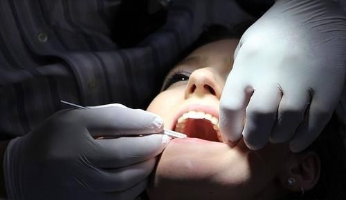 磨牙|来自牙医的忠告:千万别把智齿一次性拔完,真不是想多收钱