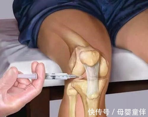 护膝操|家里老人膝盖疼痛骨科专家教你护理,这套护膝操,下楼不再疼痛