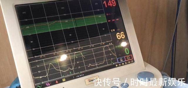 顺产|剖腹产就是打一针睡一觉看看这根腰椎针的长度,还仅仅是个开头