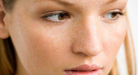 妇科|女性若有妇科炎症,脸上可能会有3个“标记”!希望你1个也没