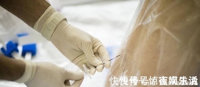 分娩|国家力推“无痛分娩针”,便宜又好用,为何孕妈宁愿疼哭都不打?