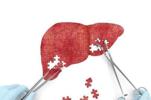 身体比较健康|肝病不能“拖”,如厕时如果有2个现象,可能是肝在向你“求救”