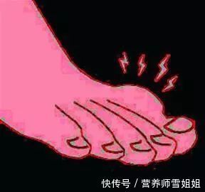 发病|冬季,痛风高发,这4类人,一旦出现3个症状,尿酸高的可怕了