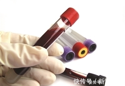 血脂|血脂四项中只是甘油三酯偏高，其它三项正常，这说明了什么问题？