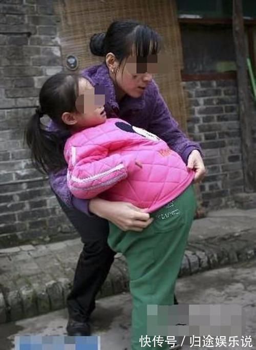 怀孕|4岁女孩肚子1米粗,像怀孕五个月,爷爷却说没事,吃的多胖点好