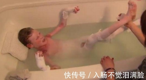 乔纳森|男孩皮肤一碰就流血,每天裹满纱布,泡在浴缸里减轻痛苦