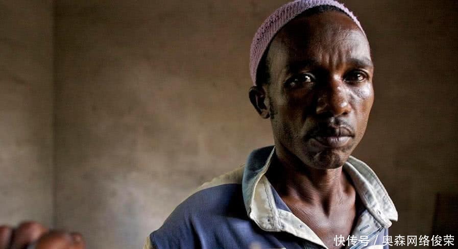 艾滋病前期不痛不痒,但会出现以下3种现象,早知早好