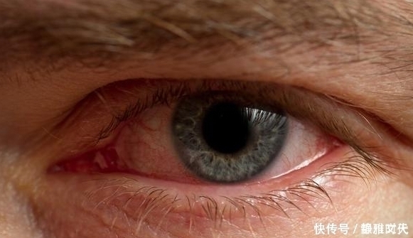 决明子|身体这4个表现说明“肝毒深”，3个养肝法，每天花2分钟护肝