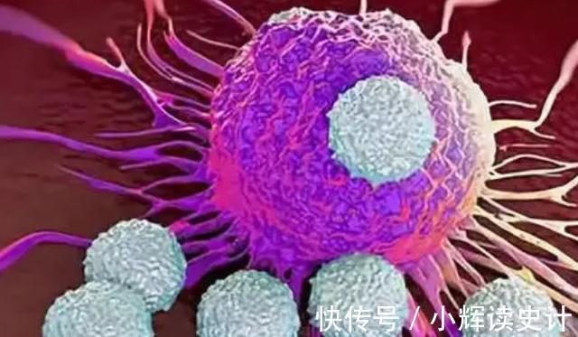 生存率|癌症多久不复发算治愈?若4项指标全正常,或离治愈不远了