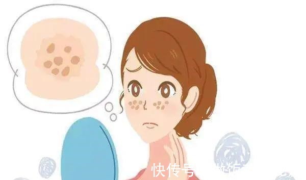 化妆品 脸上长斑怎么调理去除色斑的护肤品有哪些!