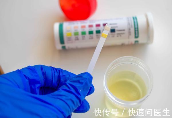 三角区|膀胱出现这4个症状,可能是膀胱癌的前兆,早发现早治疗