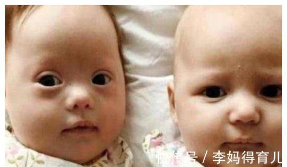 高龄产妇|怀孕期间若有4种情况之一,生出唐氏儿,希望你一个也没有