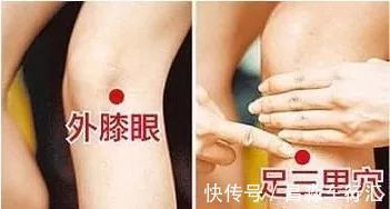 癌变|大家好!我叫“息肉”,癌症的近亲!我最怕无情又温柔的手术刀：艾灸