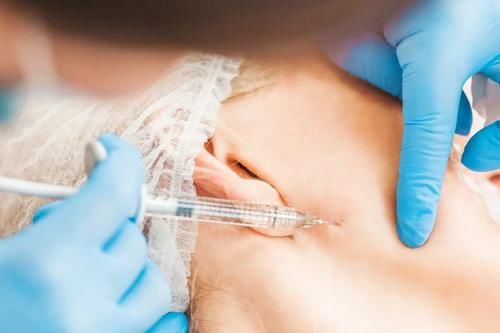 脸上出现4个信号，说明你正在衰老