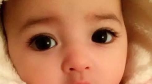 地方|宝宝出生时，这3个地方越丑，长大后颜值越高能占一条就偷笑吧