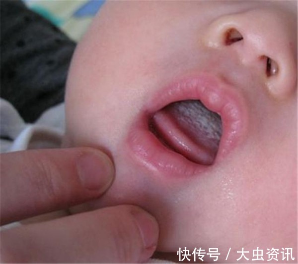 小乐|入秋后的“长高王”,医生:吃一口相当于喝5瓶奶,孩子不妨多吃