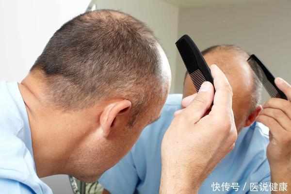 医生|肾是“拖垮”的?医生告诫:身体出现5种异样,越早就医越好!