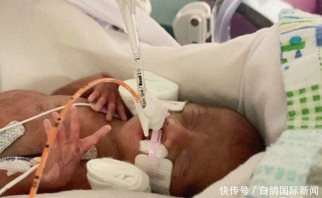 威廉|回国前两天,英国女子在美早产,却因没保险面临高额医药费