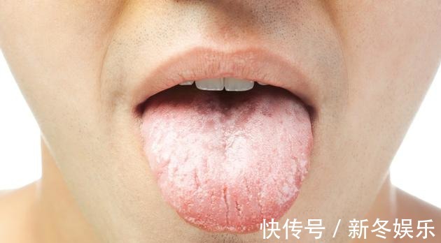病人|如何检查自己是否有癌症前兆医生看舌头!这4种舌象要注意